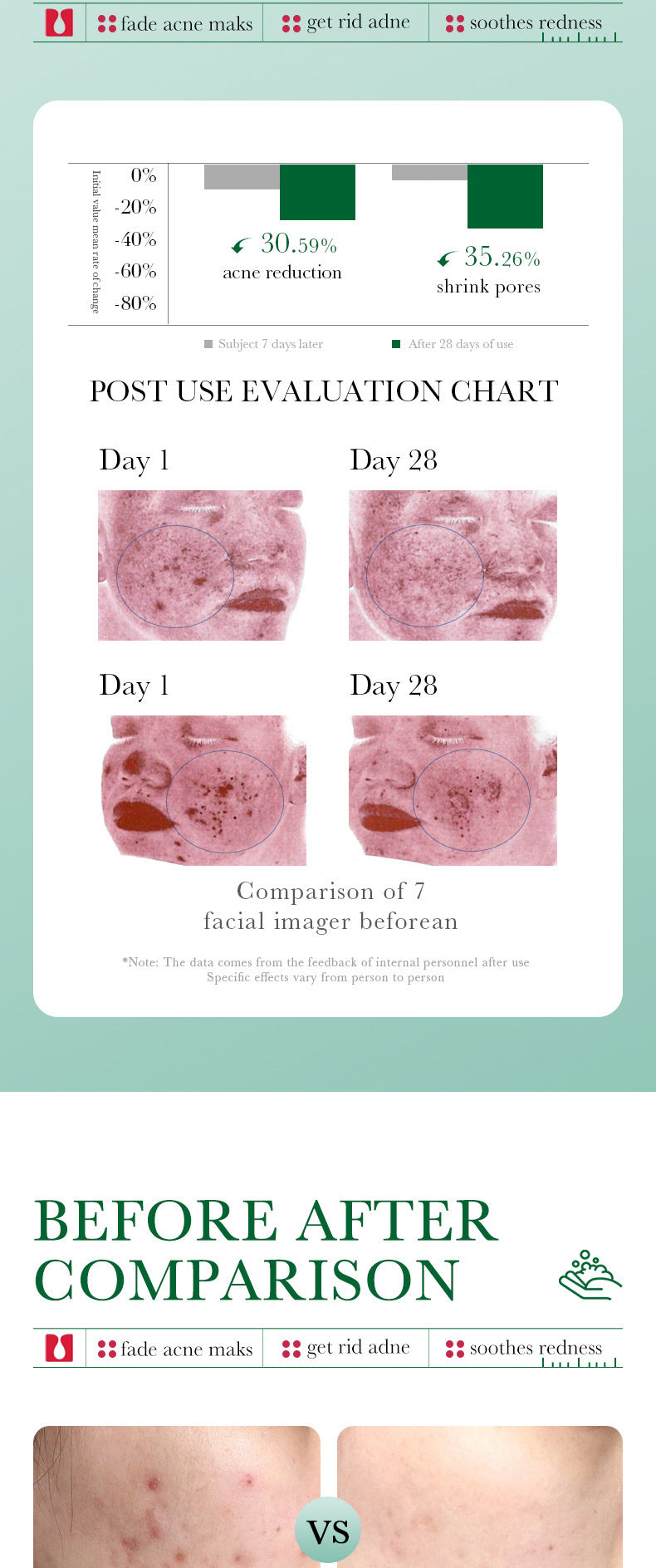 BIOAQUA Salicylic Acid Facial Cleanser Acne Treatment Moisturizing Oil Control skincare Face Wash Foam Face Cleanser Skin Care.2026 CREMA FACIAL DE ACIDO SALISILICO MEJORA LA APRIENCIA FACIAL Y ACTUA CONTRA EL ACNES. PROTEGE Y RESTABLECE LA ELASTICIDAD