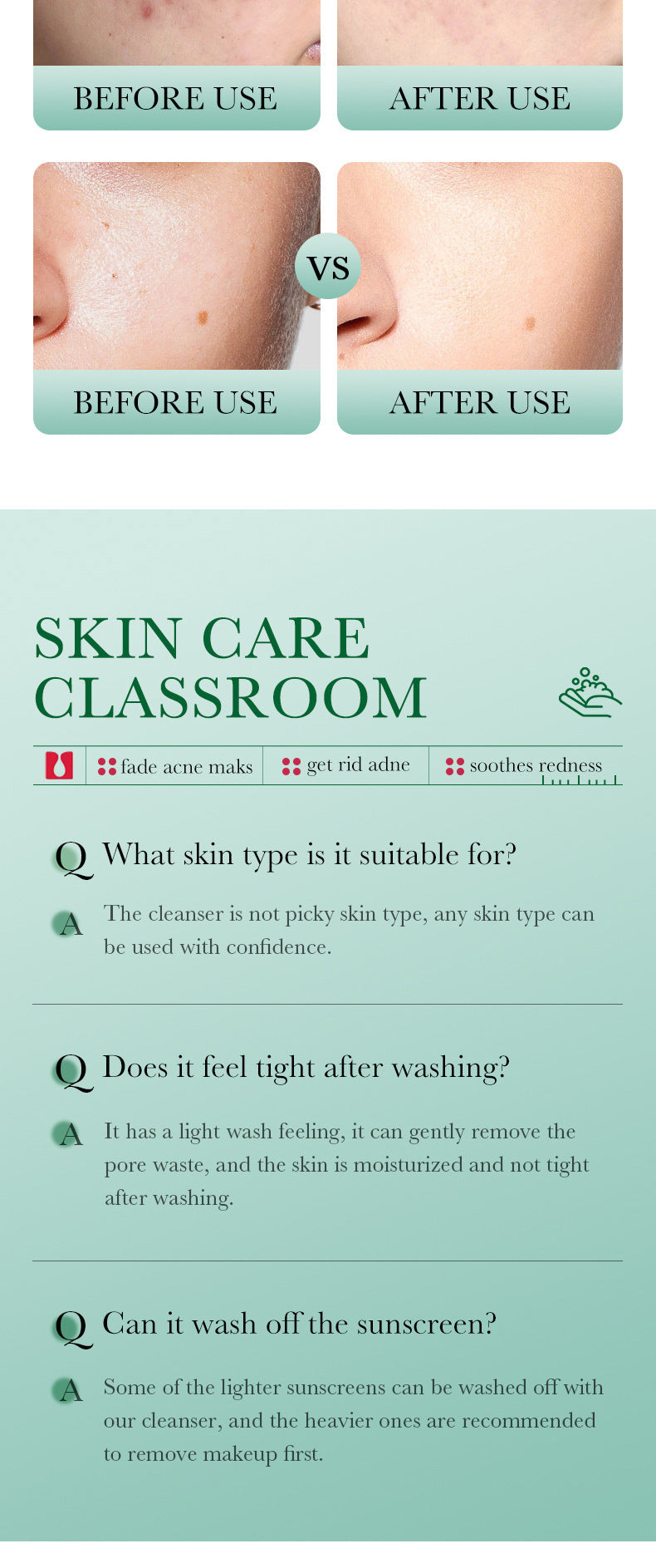BIOAQUA Salicylic Acid Facial Cleanser Acne Treatment Moisturizing Oil Control skincare Face Wash Foam Face Cleanser Skin Care.2026 CREMA FACIAL DE ACIDO SALISILICO MEJORA LA APRIENCIA FACIAL Y ACTUA CONTRA EL ACNES. PROTEGE Y RESTABLECE LA ELASTICIDAD