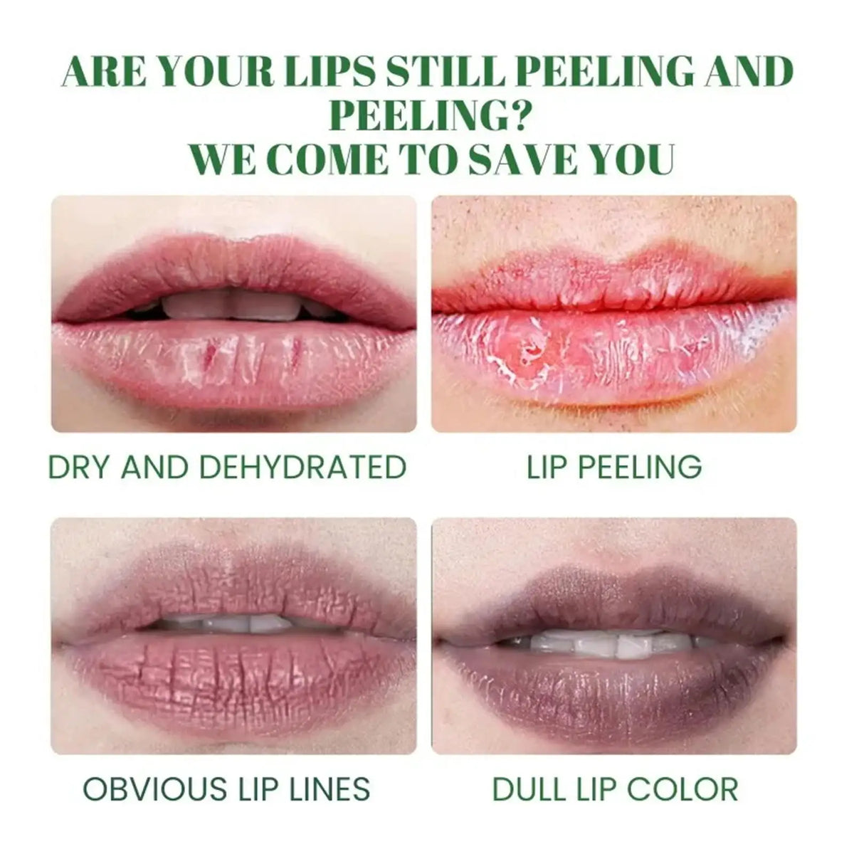 Remove Dark Lip Balm Lightening Melanin Mask Gloss Oil Exfoliating Clean Moisturizer Korean Care Products Makeup Beauty Health.2026 RESTAURACION DE TU COLOR NATURAL DE LABIOS Y PROTECTOR CONTRA MANCHAS