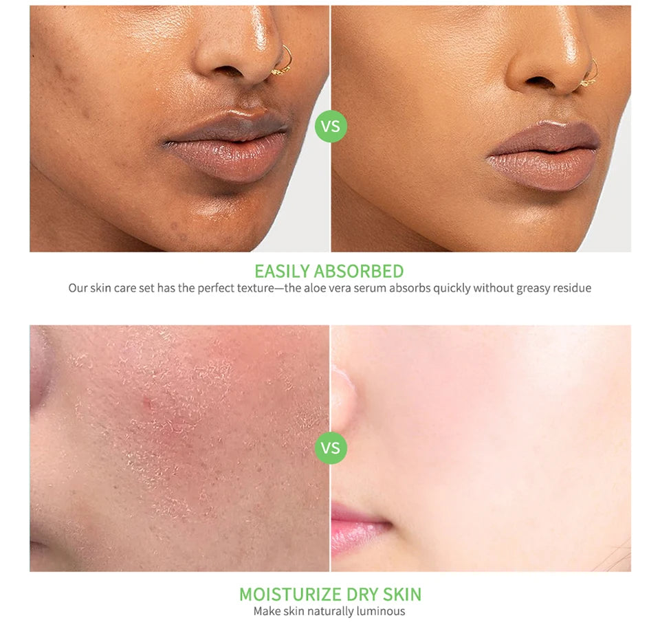 Multi-skin Care Aloe Vera Skin Care Set Deep Moisturizing Deep Nourishment Whitening Brightening Hydrating Smooth Skin. 2026 HIDRATANTE FACIAL DE ALOE VERA. HIDRATANTE SUPREME CONTRA ARRUGAS Y MANCHAS
