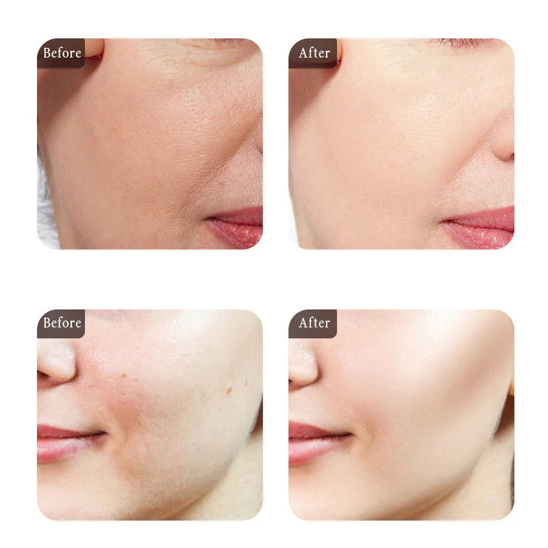 Moisturizing Face Serum and Cream Brighten Firming Anti-wrinkle Collagen Pre-Essence Caviar Eye Cream Dark Circle Eyebag Remover 2026 Eliminador de Ojeras y Bolsas en Los Ojos