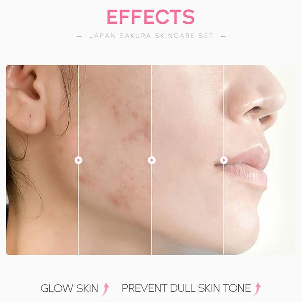 5/3pcs/Set Sakura Skin Care Sets Face Cream Serum Toner Facial Cleanser Sunscreen Eye Cream Gift Box Face Skin Care Set Product.2026 SERUM FACIAL. HUMECTANTE FACIL. REJUVENECEDOR PROTECCION CONTRA ARRUGAS FACIALES