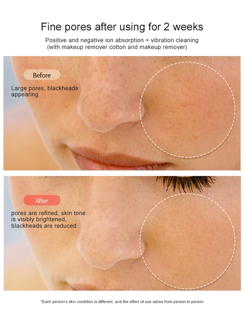 NEW Face Beauty Care Devices Multifunction Photon Skin EMS Massage Red Blue Light Anti Aging Tighten Wrinkle Removal Skin Care. 2026 DISPOSITIVO PARA LIMPIEZA FACIAL. AYUDA EL ESTIRAMIENTO.