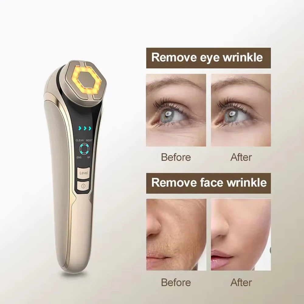 NEW Face Beauty Care Devices Multifunction Photon Skin EMS Massage Red Blue Light Anti Aging Tighten Wrinkle Removal Skin Care. 2026 DISPOSITIVO PARA LIMPIEZA FACIAL. AYUDA EL ESTIRAMIENTO.