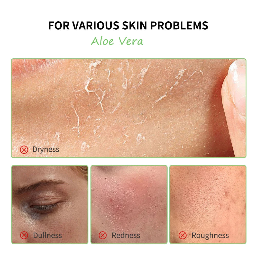 Multi-skin Care Aloe Vera Skin Care Set Deep Moisturizing Deep Nourishment Whitening Brightening Hydrating Smooth Skin. 2026 HIDRATANTE FACIAL DE ALOE VERA. HIDRATANTE SUPREME CONTRA ARRUGAS Y MANCHAS