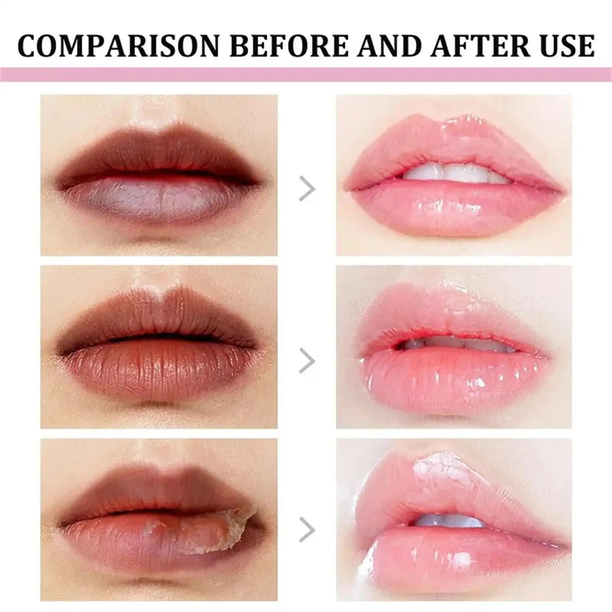 Remove Dark Lip Balm Lightening Melanin Mask Gloss Oil Exfoliating Clean Moisturizer Korean Care Products Makeup Beauty Health.2026 RESTAURACION DE TU COLOR NATURAL DE LABIOS Y PROTECTOR CONTRA MANCHAS