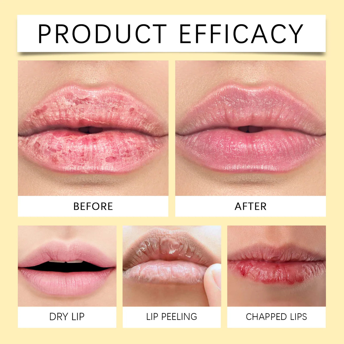 Remove Dark Lip Balm Lightening Melanin Mask Gloss Oil Exfoliating Clean Moisturizer Korean Care Products Makeup Beauty Health.2026 RESTAURACION DE TU COLOR NATURAL DE LABIOS Y PROTECTOR CONTRA MANCHAS